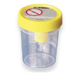 CONTENITORE URINA STERILE MEDIPRESTERIL CON SISTEMA TRANSFERT PER PROVETTE SOTTOVUOTO - Luckyfarma.it
